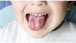 ##IMAGE##