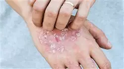 ##IMAGE##