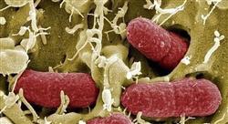 curso microbiota homeostasis intestinal enfermeria Tech Universidad