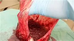 ##IMAGE##
