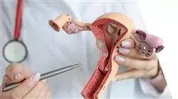 ##IMAGE##