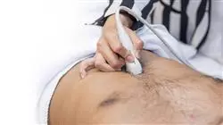 ##IMAGE##