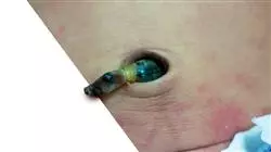 ##IMAGE##