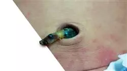 ##IMAGE##