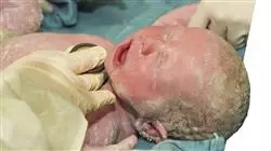##IMAGE##
