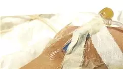 ##IMAGE##