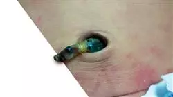 ##IMAGE##