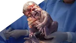 ##IMAGE##
