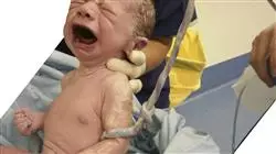 ##IMAGE##