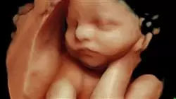 ##IMAGE##
