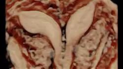 ##IMAGE##