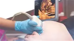 ##IMAGE##