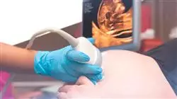 ##IMAGE##