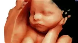 ##IMAGE##