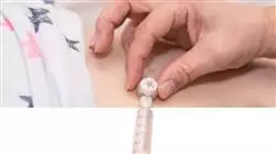 ##IMAGE##