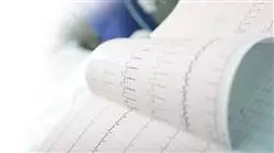 ##IMAGE##