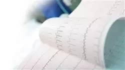 ##IMAGE##