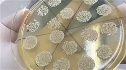 posgrado proteomica microbiologia clinica enfermeria