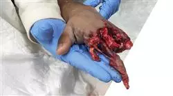 ##IMAGE##