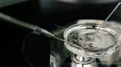 ##IMAGE##