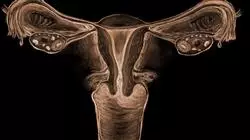 diplomado online estudio infertilidad mujer enfermeria servicio reproduccion asistida