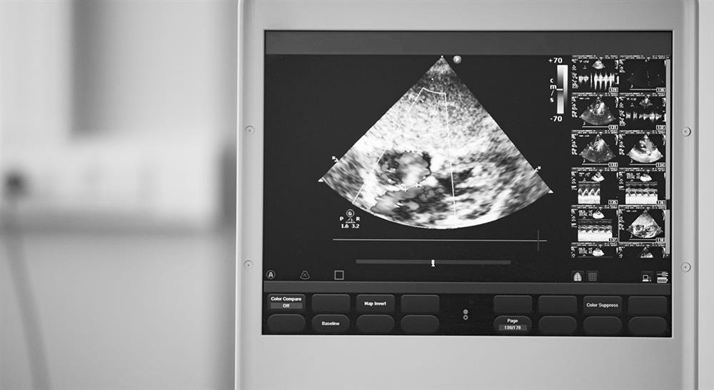 especializacion ecografía clínica cardiotorácica para emergencias y cuidados críticos para enfermería