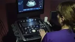 cursos ecografia clinica cardiovascular emergencias cuidados criticos enfermeria