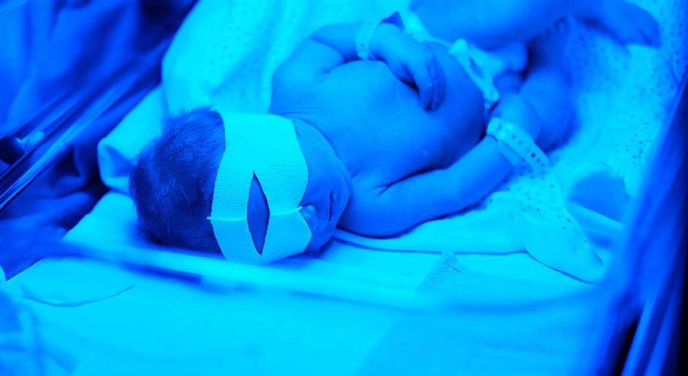 curso reanimación neonatal para enfermería