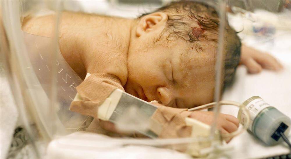 posgrado administración de medicamentos en neonatología para enfermería
