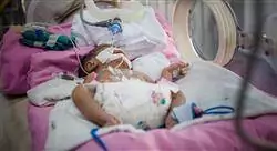 curso online neonato prematuro para enfermería