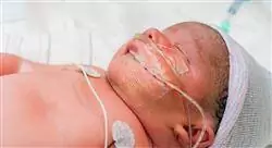 posgrado neonato prematuro para enfermería