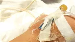 ##IMAGE##