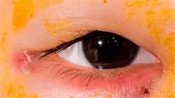 ##IMAGE##