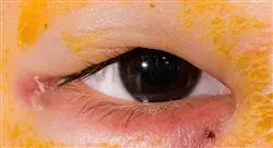especialización patología ocular