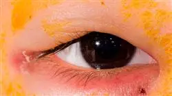 ##IMAGE##