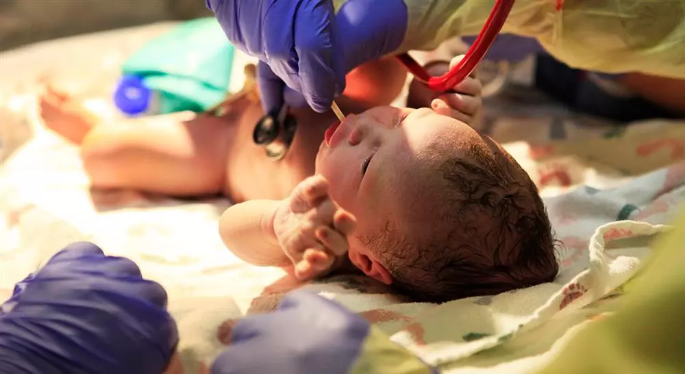 curso online situaciones especiales del recién nacido y la lactancia materna para enfermería