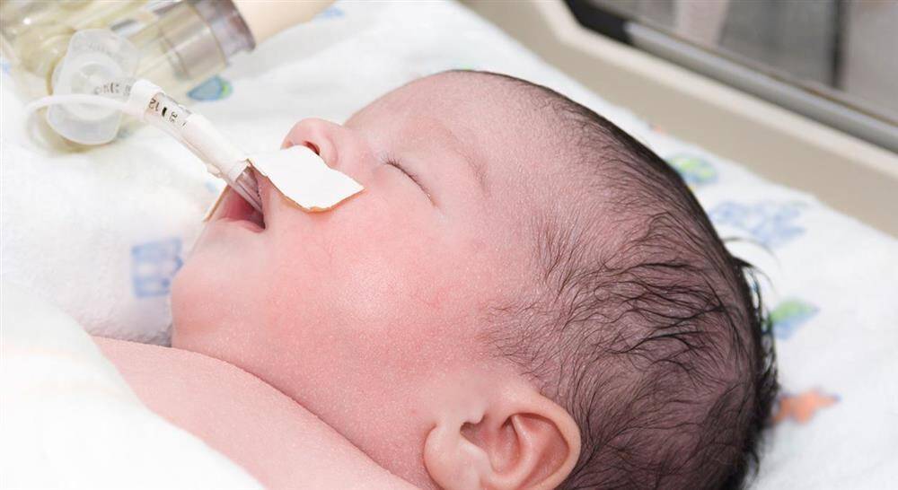 formacion cuidados en neumología neonatal para enfermería