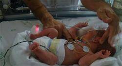 diplomado cuidados renales y hematológicos neonatales para enfermería