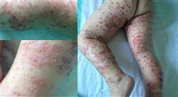 formacion urgencias pediátricas infecciosas y nefrourológicas para enfermería