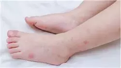 ##IMAGE##