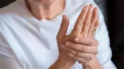 ##IMAGE##