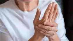 ##IMAGE##