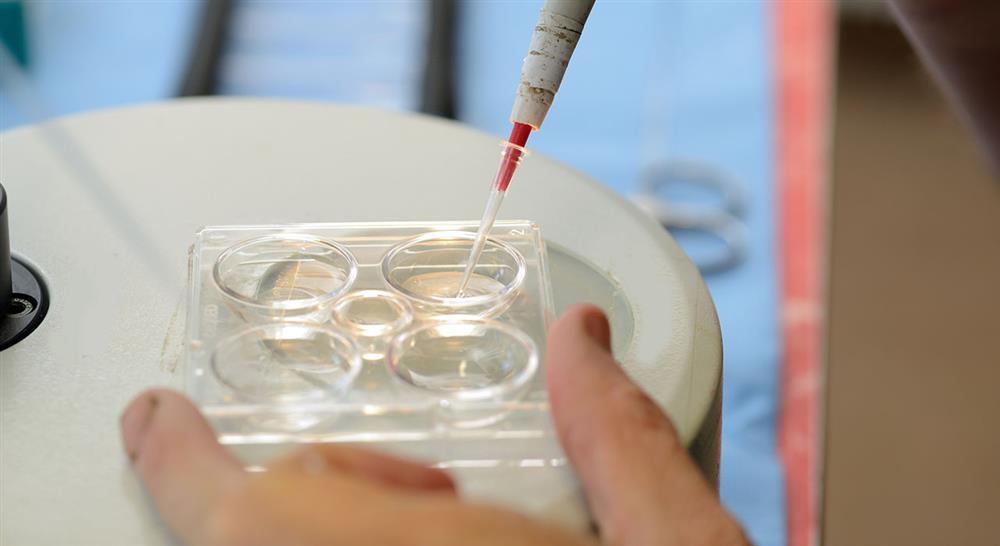 formacion nutrigenética: polimorfismos claves para enfermería