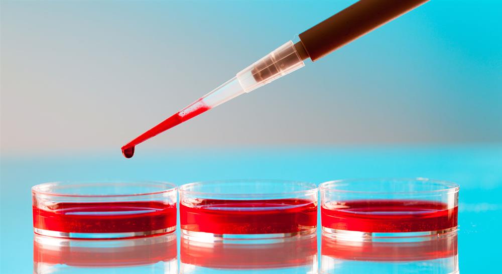 experto universitario nutrición genómica y de precisión laboratorio bioestadística y mercado actual para enfermería