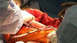 master online enfermeria servicio traumatologia