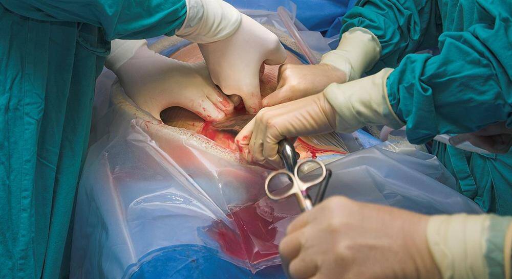 especializacion online enfermería en cuidados perioperatorios