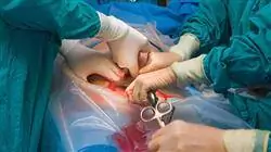 experto anestesiologia quirurgica enfermeria 