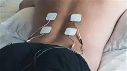 ##IMAGE##