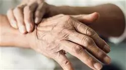 diplomado online fisioterapia neurologica parkinson otras enfermedades neurodegenerativas relacionadas