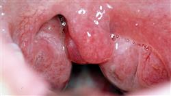 formacion microbiota oral respiratoria
